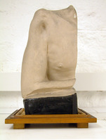 GC.13688
<br/>
Plaster model of a shoulder showing a healed gunshot wound from the American Civil War
<br/>
<em></em>